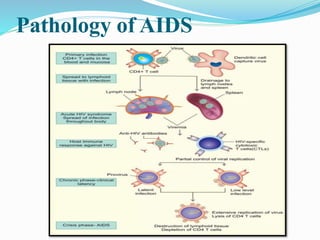 Pathology of AIDS
 