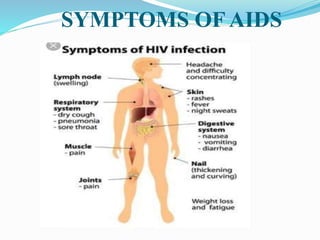 SYMPTOMS OF AIDS
 