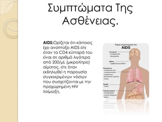Συμπτώματα Της
Ασθένειας.
AIDS:Ορίζεται ότι κάποιος
έχει αναπτύξει AIDS είτε
όταν τα CD4 κύτταρά του
είναι σε αριθμό λιγότερα
από 200/μL (μικρολίτρο)
αίματος, είτε όταν
εκδηλωθεί η παρουσία
συγκεκριμένων νόσων
που συσχετίζονται με την
προχωρημένη HIV
λοίμωξη.

 