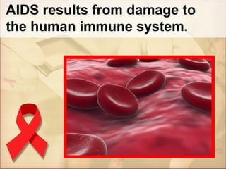 AIDS results from damage to the human immune system. 