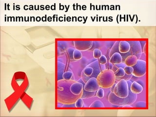 It is caused by the human immunodeficiency virus (HIV). 