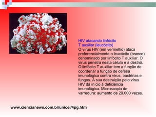 HIV atacando linfócito
T auxiliar (leucócito)
O vírus HIV (em vermelho) ataca
preferencialmente o leucócito (branco)
denominado por linfócito T auxiliar. O
vírus penetra nesta célula e a destrói.
O linfócito T auxiliar tem a função de
coordenar a função de defesa
imunológica contra vírus, bactérias e
fungos. A sua destruição pelo vírus
HIV dá início à deficiência
imunológica. Microscopia de
varredura: aumento de 20.000 vezes.
www.ciencianews.com.br/unicel/4pg.htm
 