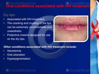 Oral conditions associated with HIV treatment
Dry lips:
• Associated with HIV-treatment.
• The cracking and crusting of the lips
can be extremely uncomfortable and
unaesthetic.
• Protective creams designed for use
on the dry lips.
Other conditions associated with HIV treatment include:
• Xerostomia
• Oral ulceration
• Hyperpigmentation
 