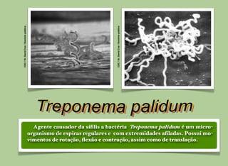 CDC /Dr. DavidCox/Domíniopúblico
CDC /Dr. DavidCox/Domíniopúblico
Agente causador da síﬁlis a bactéria Treponema palidum é um micro-
organismo de espiras regulares e com extremidades aﬁladas. Possui mo-
vimentos de rotação, ﬂexão e contração, assim como de translação.
 