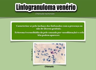 Caracteriza-se pelo inchaço dos linfonodos com a presença ou
não de úlceras genitais.
Eritrema (vermelhidão da pele causada por vasodilatação) e cefa-
léia podem aparecer.
Chlamydia trachomatis
Chlamydia
CDC/DorothyReese
 