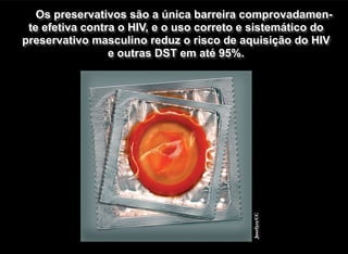 Josef325/CC
Os preservativos são a única barreira comprovadamen-
te efetiva contra o HIV, e o uso correto e sistemático do
preservativo masculino reduz o risco de aquisição do HIV
e outras DST em até 95%.
 