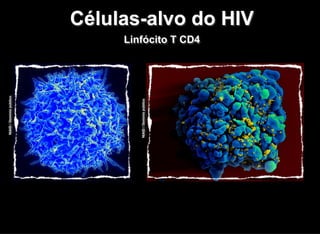 NIAID/Domíniopúblico
NIAID/Domíniopúblico
Células-alvo do HIV
Linfócito T CD4
 