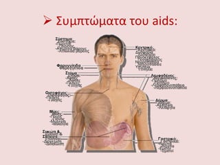  Συμπτώματα του aids:
 