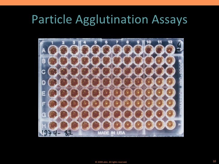 AIDS/HIV Testing Methodology (www.ubio.in)