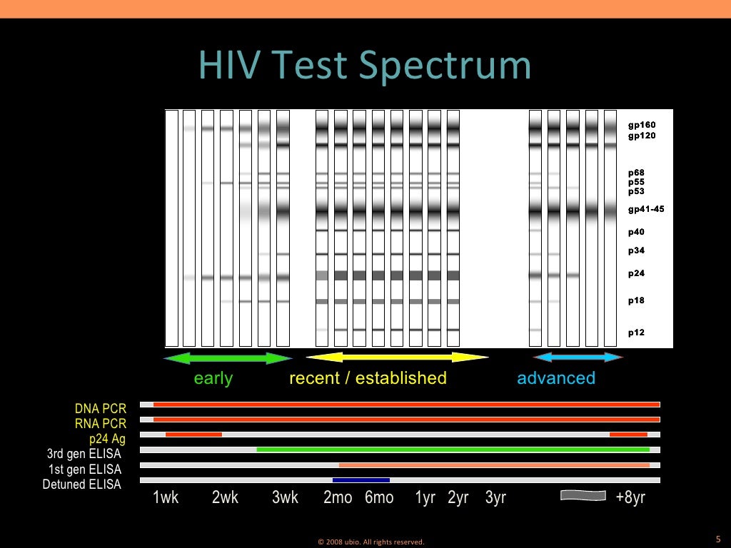 AIDS/HIV Testing Methodology (www.ubio.in)