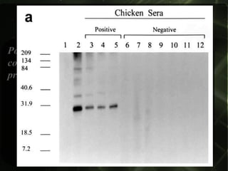 WESTERN-BLOT

Possui sua alta especificidade (99,7%), é
considerado exame confirmatório;
praticamente não existem falsos-positivos.
 