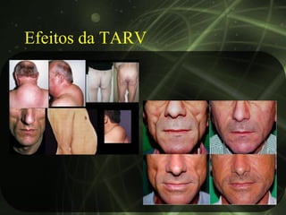 Efeitos da TARV
 