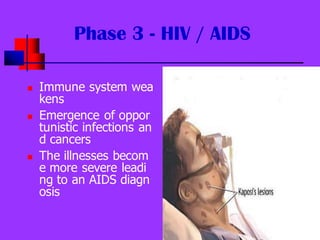 Phase 3 - HIV / AIDS
◼ Immune system wea
kens
◼ Emergence of oppor
tunistic infections an
d cancers
◼ The illnesses becom
...
