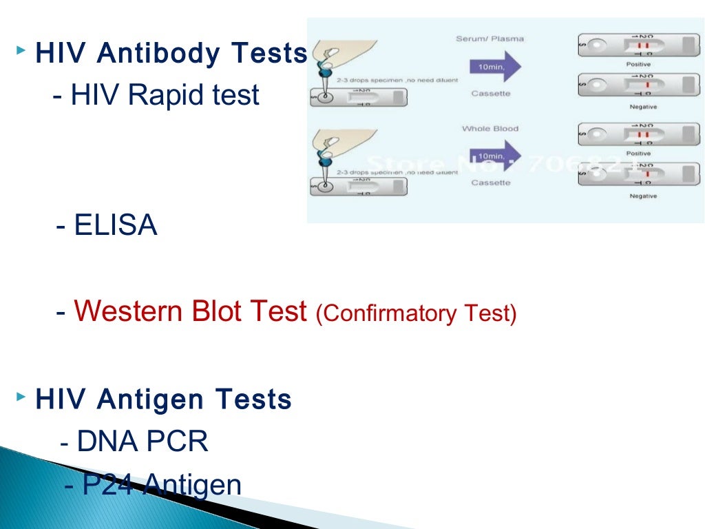 Ppt On Aids ppt-on-aids