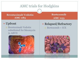 Brentuximab Vedotin
AMC 085
Bortezomib
AMC 053
 Upfront
 Brentuximab Vedotin
substituted for bleomycin
in ABVD
AMC trials for Hodgkins
 Relapsed/Refractory
 Bortezomib + ICE
 
