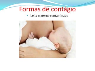 Formas de contágio
• Leite materno contaminado

 