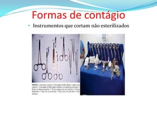Formas de contágio
• Instrumentos que cortam não esterilizados

 