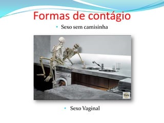 Formas de contágio
• Sexo sem camisinha

• Sexo Vaginal

 