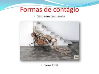 Formas de contágio
• Sexo sem camisinha

• Sexo Oral

 