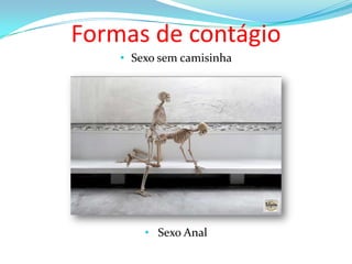 Formas de contágio
• Sexo sem camisinha

• Sexo Anal

 