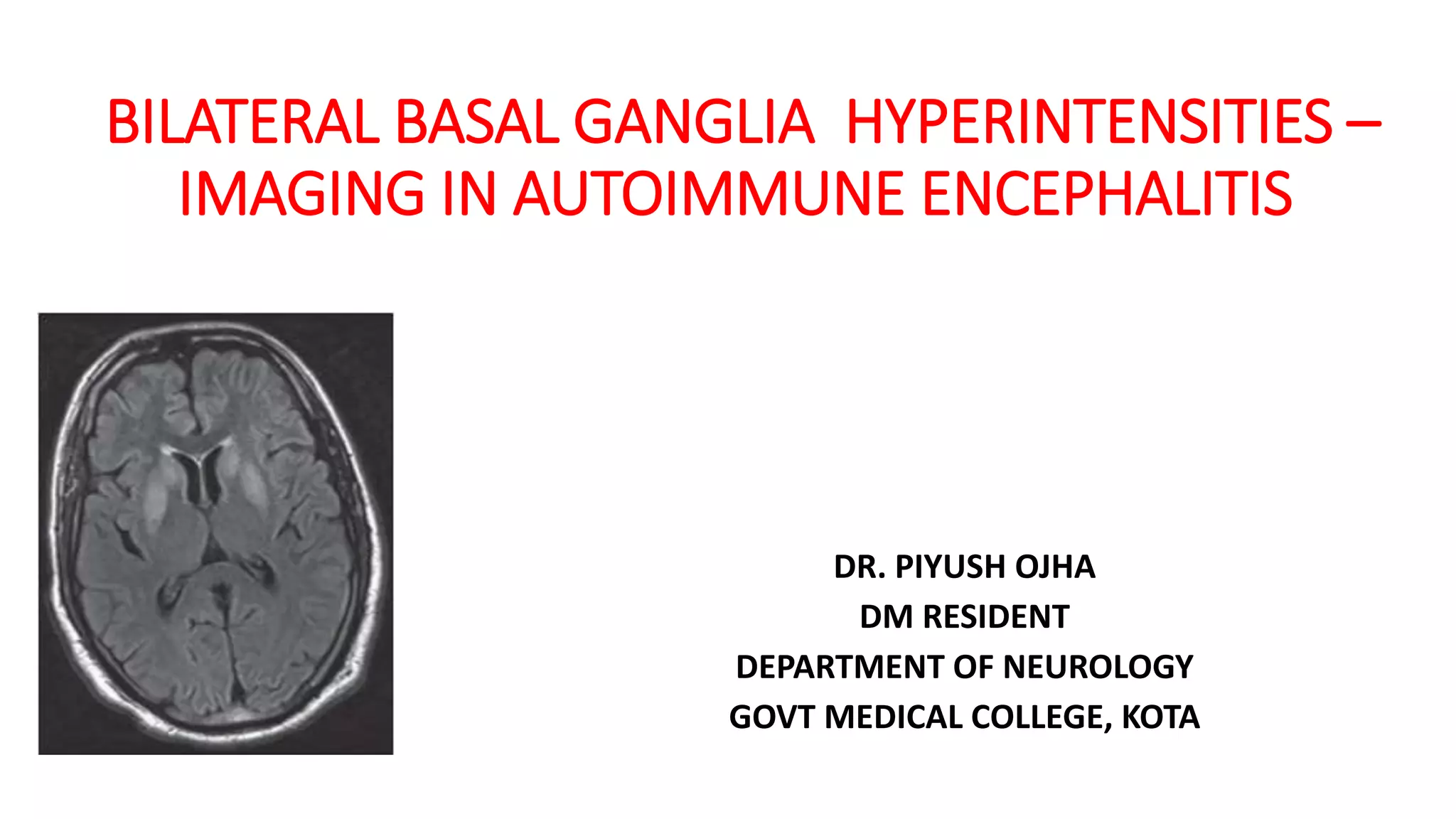 Unilateral Basal Ganglia T1 Hyperintensity