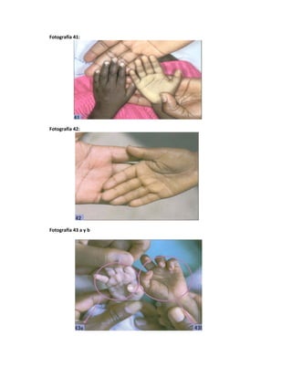 Fotografía 41:
Fotografía 42:
Fotografía 43 a y b
 