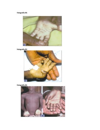 Fotografía 44:
Fotografía 45:
Fotografía 46:
 