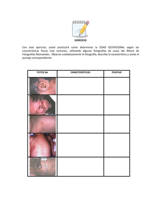 EJERCICIO
Con este ejercicio, usted practicará como determinar la EDAD GESTACIONAL según las
características físicas más comunes, utilizando algunas fotografías de casos del Álbum de
Fotografías Neonatales. Observe cuidadosamente la fotografía, describa la característica y anote el
puntaje correspondiente:
FOTOS No CARACTERISTICAS PUNTAJE
 