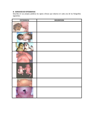 B. EJERCICIOS DE FOTOGRAFIAS
Describa en sus propias palabras los signos clínicos que observa en cada una de las fotografías
siguientes:
FOTOGRAFIA DESCRIPCION
 