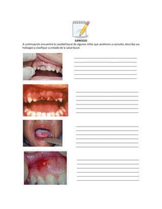 EJERCICIO
A continuación encuentra la cavidad bucal de algunos niños que asistieron a consulta, describa sus
hallazgos y clasifique su estado de la salud bucal.
___________________________________________
___________________________________________
___________________________________________
___________________________________________
___________________________________________
___________________________________________
___________________________________________
___________________________________________
___________________________________________
___________________________________________
___________________________________________
___________________________________________
___________________________________________
___________________________________________
___________________________________________
___________________________________________
___________________________________________
___________________________________________
___________________________________________
___________________________________________
___________________________________________
___________________________________________
___________________________________________
___________________________________________
 