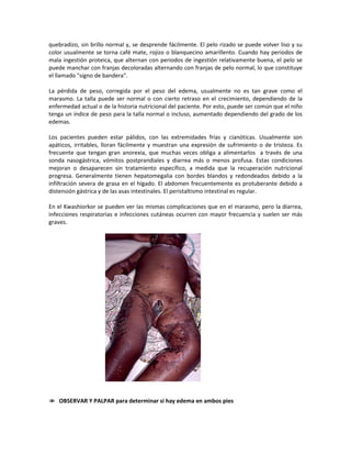 quebradizo, sin brillo normal y, se desprende fácilmente. El pelo rizado se puede volver liso y su
color usualmente se torna café mate, rojizo o blanquecino amarillento. Cuando hay periodos de
mala ingestión proteica, que alternan con periodos de ingestión relativamente buena, el pelo se
puede manchar con franjas decoloradas alternando con franjas de pelo normal, lo que constituye
el llamado "signo de bandera".
La pérdida de peso, corregida por el peso del edema, usualmente no es tan grave como el
marasmo. La talla puede ser normal o con cierto retraso en el crecimiento, dependiendo de la
enfermedad actual o de la historia nutricional del paciente. Por esto, puede ser común que el niño
tenga un índice de peso para la talla normal o incluso, aumentado dependiendo del grado de los
edemas.
Los pacientes pueden estar pálidos, con las extremidades frías y cianóticas. Usualmente son
apáticos, irritables, lloran fácilmente y muestran una expresión de sufrimiento o de tristeza. Es
frecuente que tengan gran anorexia, que muchas veces obliga a alimentarlos a través de una
sonda nasogástrica, vómitos postprandiales y diarrea más o menos profusa. Estas condiciones
mejoran o desaparecen sin tratamiento específico, a medida que la recuperación nutricional
progresa. Generalmente tienen hepatomegalia con bordes blandos y redondeados debido a la
infiltración severa de grasa en el hígado. El abdomen frecuentemente es protuberante debido a
distensión gástrica y de las asas intestinales. El peristaltismo intestinal es regular.
En el Kwashiorkor se pueden ver las mismas complicaciones que en el marasmo, pero la diarrea,
infecciones respiratorias e infecciones cutáneas ocurren con mayor frecuencia y suelen ser más
graves.
 OBSERVAR Y PALPAR para determinar si hay edema en ambos pies
 