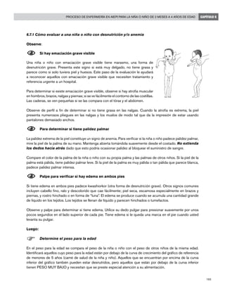 165
Proceso de enfermería en AIEPI para la niña o niño de 2 meses a 4 años de edad CAPÍTULO 6
6.7.1 Cómo evaluar a una niña o niño con desnutrición y/o anemia
Observe:
N	Si hay emaciación grave visible
Una niña o niño con emaciación grave visible tiene marasmo, una forma de
desnutrición grave. Presenta este signo si está muy delgado, no tiene grasa y
parece como si solo tuviera piel y huesos. Este paso de la evaluación le ayudará
a reconocer aquellos con emaciación grave visible que necesiten tratamiento y
referencia urgente a un hospital.
Para determinar si existe emaciación grave visible, observe si hay atrofia muscular
en hombros, brazos, nalgas y piernas; si se ve fácilmente el contorno de las costillas.
Las caderas, se ven pequeñas si se las compara con el tórax y el abdomen.
Observe de perfil a fin de determinar si no tiene grasa en las nalgas. Cuando la atrofia es extrema, la piel
presenta numerosos pliegues en las nalgas y los muslos de modo tal que da la impresión de estar usando
pantalones demasiado anchos.
N	Para determinar si tiene palidez palmar
La palidez extrema de la piel constituye un signo de anemia. Para verificar si la niña o niño padece palidez palmar,
mire la piel de la palma de su mano. Mantenga abierta tomándola suavemente desde el costado. No extienda
los dedos hacia atrás dado que esto podría ocasionar palidez al bloquear el suministro de sangre.
Compare el color de la palma de la niña o niño con su propia palma y las palmas de otros niños. Si la piel de la
palma está pálida, tiene palidez palmar leve. Si la piel de la palma es muy pálida o tan pálida que parece blanca,
padece palidez palmar intensa.
N	Palpe para verificar si hay edema en ambos pies
Si tiene edema en ambos pies padece kwashiorkor (otra forma de desnutrición grave). Otros signos comunes
incluyen cabello fino, ralo y descolorido que cae fácilmente; piel seca, escamosa especialmente en brazos y
piernas, y rostro hinchado o en forma de “luna”. El edema se produce cuando se acumula una cantidad grande
de líquido en los tejidos. Los tejidos se llenan de líquido y parecen hinchados o tumefactos.
Observe y palpe para determinar si tiene edema. Utilice su dedo pulgar para presionar suavemente por unos
pocos segundos en el lado superior de cada pie. Tiene edema si le queda una marca en el pie cuando usted
levanta su pulgar.
Luego:
F	Determine el peso para la edad
En el peso para la edad se compara el peso de la niña o niño con el peso de otros niños de la misma edad.
Identificará aquellos cuyo peso para la edad están por debajo de la curva de crecimiento del gráfico de referencia
de menores de 5 años (carné de salud de la niña y niño). Aquellos que se encuentran por encima de la curva
inferior del gráfico también pueden estar desnutridos, pero aquellos que están por debajo de la curva inferior
tienen PESO MUY BAJO y necesitan que se preste especial atención a su alimentación.
 