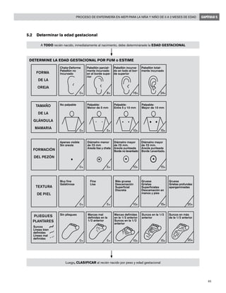85
Proceso de enfermería en AIEPI para la niña y niño de 0 a 2 meses de edad CAPÍTULO 5
5.2	 Determinar la edad gestacional
DETERMINE LA EDAD GESTACIONAL POR FUM o ESTIME
A TODO recién nacido, inmediatamente al nacimiento, debe determinársele la EDAD GESTACIONAL
0* 8* 16* 24*
0* 5* 10* 15*
0* 5* 10* 15*
0* 5* 10* 15*15*
0* 5* 10* 15*
20*
20*
Chata-Deforme
Pabellón no
IncurvadoFORMA
DE LA
OREJA
FORMACIÓN
DEL PEZÓN
TEXTURA
DE PIEL
PLIEGUES
PLANTARES
TAMAÑO
DE LA
GLÁNDULA
MAMARIA
No palpable
Apenas visible
Sin areola
Muy fina
Gelatinosa
Sin pliegues
Surcos
Líneas bien
definidas
Líneas mal
definidas
Marcas mal
definidas en la
1/2 anterior
Marcas definidas
en la 1/2 anterior
Surcos en la 1/2
anterior
Surcos en la 1/2
anterior
Surcos en más
de la 1/2 anterior
Fina
Lisa
Más gruesa
Descamación
Superficial
Discreta
Gruesa
Grietas
Superficiales
Descamación en
manos y pies
Gruesa
Grietas profundas
apergaminadas
Diámetro menor
de 7.5 mm
Areola lisa y chata
Diámetro mayor
de 7.5 mm.
Areola punteada
Borde no levantado
Diámetro mayor
de 7.5 mm.
Areola punteada
Borde Levantado.
Palpable:
Menor de 5 mm
Palpable:
Entre 5 y 10 mm
Palpable:
Mayor de 10 mm
Pabellón parcial-
mente incurvado
en el borde supe-
rior
Pabellón incurva-
do en todo el bor-
de superior
Pabellón total-
mente incurvado
Luego, CLASIFICAR al recién nacido por peso y edad gestacional
 