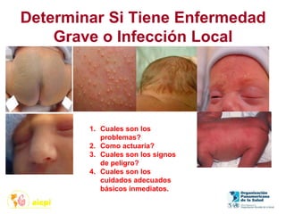 Determinar Si Tiene Enfermedad
Grave o Infección Local
1. Cuales son los
problemas?
2. Como actuaría?
3. Cuales son los signos
de peligro?
4. Cuales son los
cuidados adecuados
básicos inmediatos.
 