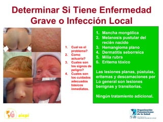 Determinar Si Tiene Enfermedad
Grave o Infección Local
1. Cual es el
problema?
2. Como
actuaría?
3. Cuales son
los signos de
peligro?
4. Cuales son
los cuidados
adecuados
básicos
inmediatos.
1. Mancha mongólica
2. Melanosis pustular del
recién nacido
3. Hemangioma plano
4. Dermatitis seborreica
5. Milia rubra
6. Eritema tóxico
Las lesiones planas, pústulas,
eritemas y descamaciones por
Lo general son lesiones
benignas y transitorias.
Ningún tratamiento adicional.
 