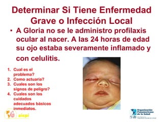 Determinar Si Tiene Enfermedad
Grave o Infección Local
• A Gloria no se le administro profilaxis
ocular al nacer. A las 24 horas de edad
su ojo estaba severamente inflamado y
con celulitis.
1. Cual es el
problema?
2. Como actuaría?
3. Cuales son los
signos de peligro?
4. Cuales son los
cuidados
adecuados básicos
inmediatos.
 