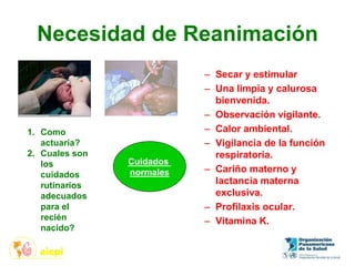 Necesidad de Reanimación
– Secar y estimular
– Una limpia y calurosa
bienvenida.
– Observación vigilante.
– Calor ambiental.
– Vigilancia de la función
respiratoria.
– Cariño materno y
lactancia materna
exclusiva.
– Profilaxis ocular.
– Vitamina K.
1. Como
actuaría?
2. Cuales son
los
cuidados
rutinarios
adecuados
para el
recién
nacido?
Cuidados
normales
 
