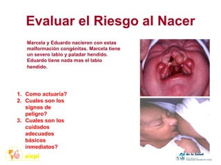 Evaluar el Riesgo al Nacer
1. Como actuaría?
2. Cuales son los
signos de
peligro?
3. Cuales son los
cuidados
adecuados
básicos
inmediatos?
Marcela y Eduardo nacieron con estas
malformación congénitas. Marcela tiene
un severo labio y paladar hendido.
Eduardo tiene nada mas el labio
hendido.
 