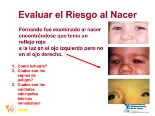 Evaluar el Riesgo al Nacer
1. Como actuaría?
2. Cuales son los
signos de
peligro?
3. Cuales son los
cuidados
adecuados
básicos
inmediatos?
Fernando fue examinado al nacer
encontrándose que tenía un
reflejo rojo
a la luz en el ojo izquierdo pero no
en el ojo derecho.
 