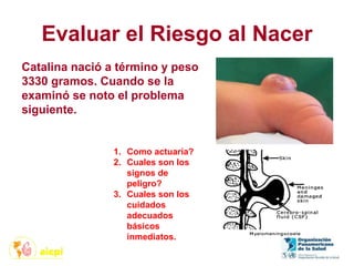 Evaluar el Riesgo al Nacer
1. Como actuaría?
2. Cuales son los
signos de
peligro?
3. Cuales son los
cuidados
adecuados
básicos
inmediatos.
Catalina nació a término y peso
3330 gramos. Cuando se la
examinó se noto el problema
siguiente.
 