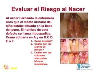 Evaluar el Riesgo al Nacer
1. Como actuaría?
2. Cuales son los
signos de
peligro?
3. Cuales son los
cuidados
adecuados
básicos
inmediatos.
Al nacer Fernando la enfermera
noto que el meato urinario del
niño estaba situado en la base
del pene. El nombre de este
defecto se llama hipospadias.
Como actuaría en A y en B.C.D.
E o F.
 