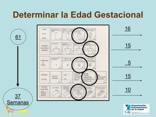 Determinar la Edad Gestacional
16
15
5
15
10
61
37
Semanas
 