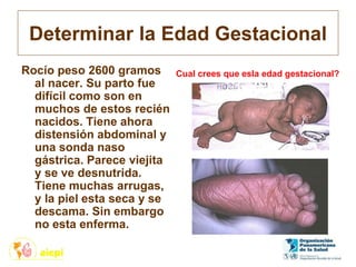 Determinar la Edad Gestacional
Rocío peso 2600 gramos
al nacer. Su parto fue
difícil como son en
muchos de estos recién
nacidos. Tiene ahora
distensión abdominal y
una sonda naso
gástrica. Parece viejita
y se ve desnutrida.
Tiene muchas arrugas,
y la piel esta seca y se
descama. Sin embargo
no esta enferma.
Cual crees que esla edad gestacional?
 