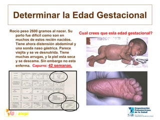 Determinar la Edad Gestacional
Rocío peso 2600 gramos al nacer. Su
parto fue difícil como son en
muchos de estos recién nacidos.
Tiene ahora distensión abdominal y
una sonda naso gástrica. Parece
viejita y se ve desnutrida. Tiene
muchas arrugas, y la piel esta seca
y se descama. Sin embargo no esta
enferma. Capurro: 42 semanas.
Cual crees que esla edad gestacional?
 
