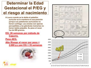 Determinar la Edad
Gestacional el P/EG y
el riesgo al nacimiento
A Laura cuando se le dobla el pabellón
auricular se le mantiene en esa posición
porque sus pabellones auriculares no
tienen cartílago. Las areolas son apenas
perceptibles y las glándulas mamarias no
tienen tejido palpable. Su peso al nacer
fue de 800 gramos.
EG: 26 semanas por método de
Capurro.
Peso AEG.
Alto Riesgo al nacer por peso <
2.000 g y por EG < 35 semanas
 