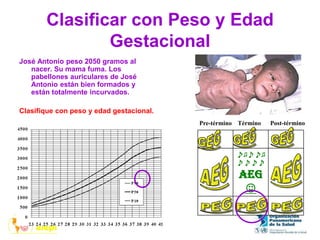 Clasificar con Peso y Edad
Gestacional
José Antonio peso 2050 gramos al
nacer. Su mama fuma. Los
pabellones auriculares de José
Antonio están bien formados y
están totalmente incurvados.
Clasifique con peso y edad gestacional.
♪♫♪♪♫
♪♪♪♪
AEG
☺
Pre-término Término Post-término
 