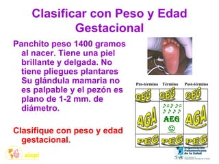 Clasificar con Peso y Edad
Gestacional
Panchito peso 1400 gramos
al nacer. Tiene una piel
brillante y delgada. No
tiene pliegues plantares
Su glándula mamaria no
es palpable y el pezón es
plano de 1-2 mm. de
diámetro.
Clasifique con peso y edad
gestacional.
♪♫♪♪♫
♪♪♪♪
AEG
☺
Pre-término Término Post-término
 