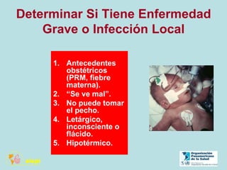 Determinar Si Tiene Enfermedad
Grave o Infección Local
1. Antecedentes
obstétricos
(PRM, fiebre
materna).
2. “Se ve mal”.
3. No puede tomar
el pecho.
4. Letárgico,
inconsciente o
flácido.
5. Hipotérmico.
 