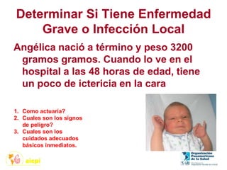 Determinar Si Tiene Enfermedad
Grave o Infección Local
Angélica nació a término y peso 3200
gramos gramos. Cuando lo ve en el
hospital a las 48 horas de edad, tiene
un poco de ictericia en la cara
1. Como actuaría?
2. Cuales son los signos
de peligro?
3. Cuales son los
cuidados adecuados
básicos inmediatos.
 