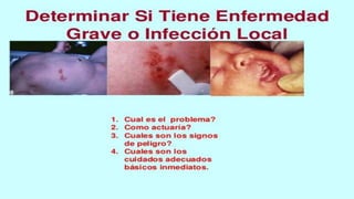 Aiepi neonatal practica